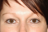 Permanent Makeup Photo Gallery