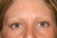 Permanent Makeup Before and After